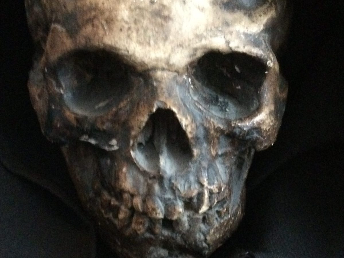 The End of Dickie’s&nbsp;Skull